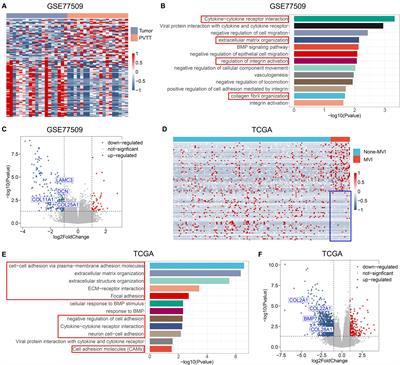 Cancer-Associated Fibroblasts Promote Vascular Invasion of Hepatocellular Carcinoma via Downregulating Decorin-integrin β1 Signaling